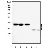 Western blot testing of 1) human HCCT, 2) human MCF-7, 3) human HepG2, 4) rat liver and 5) mouse liver tissue lysate with TTPA antibody. Predicted molecular weight ~32 kDa, commonly observed at 29-37 kDa.