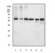 Western blot testing of 1) human Caco-2, 2) human SW620, 3) human MDA-MB-453, 4) human PC-3, 5) rat thymus and 6) mouse thymus tissue lysate with Yin and yang 1 antibody. Predicted molecular weight ~45 kDa but commonly observed at 45~65 kDa.