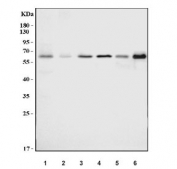 Western blot testing of 1) human Caco-2, 2) human SW620, 3) human MDA-MB-453, 4) human PC-3, 5) rat thymus and 6) mouse thymus tissue lysate with YY11 antibody. Predicted molecular weight ~45 kDa but commonly observed at 45~65 kDa.