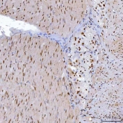 IHC staining of FFPE muscular layer of human colonic adenocarcinoma tissue with YY1 antibody. HIER: boil tissue sections in pH8 EDTA for 20 min and allow to cool before testing.