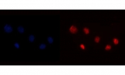 Immunofluorescent staining of FFPE human T-47D cells with YY1 antibody (red) and DAPI nuclear stain (blue). HIER: steam section in pH6 citrate buffer for 20 min.