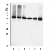 Western blot testing of 1) human Caco-2, 2) human SW620, 3) human MDA-MB-453, 4) human PC-3, 5) rat thymus and 6) mouse thymus tissue lysate with YY11 antibody. Predicted molecular weight ~45 kDa but commonly observed at 45~65 kDa.