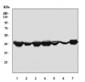 Western blot testing of 1) human HepG2, 2) human HeLa, 3) human Jurkat, 4) human K562, 5) rat liver, 6) rat RH35 and 7) mouse liver tissue lysate with ACAT2 antibody. Predicted molecular weight: ~41 kDa (isoform 1) and ~45 kDa (isoform 2).