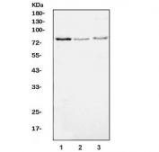 Western blot testing of 1) human Raji, 2) human Caco-2 and 3) rat PC-12 cell lysate with ADAM8 antibody. Predicted molecular weight: ~89/79 kDa (isoforms 1/3).