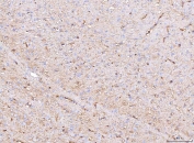 IHC staining of FFPE rat brain tissue with Aquaporin 4 antibody. HIER: boil tissue sections in pH8 EDTA for 20 min and allow to cool before testing.