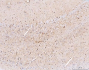 IHC staining of FFPE mouse brain tissue with Aquaporin 4 antibody. HIER: boil tissue sections in pH8 EDTA for 20 min and allow to cool before testing.