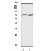 Western blot testing of 1) rat brain and 2) mouse brain tissue lysate with Choline Acetyltransferase antibody. Predicted molecular weight ~83/74/70 kDa (isoforms M/S/R).