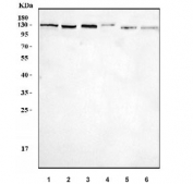 Western blot testing of 1) human Jurkat, 2) human MOLT4, 3) rat brain, 4) mouse brain, 5) mouse RAW264.7 and 6) mouse ANA-1 cell lysate with CTIP2 antibody. Predicted molecular weight ~96 kDa but the modified forms of the protein can be observed at ~130 kDa.
