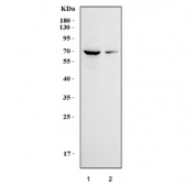 Western blot testing of human 1) Jurkat and 2) HUT-78 cell lysate with CD28 antibody. Expected molecular weight depending on level of glycosylation: ~25-44 kDa (monomer), ~50-90kDa (dimer).