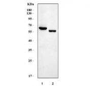 Western blot testing of 1) rat liver and 2) mouse liver tissue lysate with Cdc25b antibody. Expected molecular weight: 61~67 kDa (isoforms 1-4).