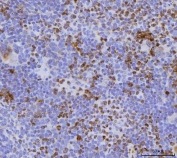 IHC staining of FFPE mouse spleen tissue with Cdc25b antibody. HIER: boil tissue sections in pH8 EDTA for 20 min and allow to cool before testing.