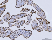 IHC staining of FFPE human placental tissue with Homeobox protein cut-like 1 antibody. HIER: boil tissue sections in pH8 EDTA for 20 min and allow to cool before testing.