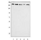 Western blot testing of 1) human K562, 2) human HeLa, 3) human MCF7, 4) human SH-SY5Y and 5) mouse stomach tissue lysate with Homeobox protein cut-like 1 antibody. Expected molecular weight ~200 kDa with smaller isoforms.