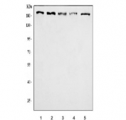 Western blot testing of 1) human K562, 2) human HeLa, 3) human MCF7, 4) human SH-SY5Y and 5) mouse stomach tissue lysate with Homeobox protein cut-like 1 antibody. Expected molecular weight ~200 kDa with smaller isoforms.