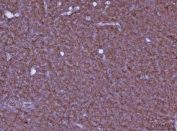 IHC staining of FFPE rat lymph node tissue with Cxcr3 antibody. HIER: boil tissue sections in pH8 EDTA for 20 min and allow to cool before testing.