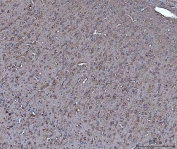 IHC staining of FFPE rat brain tissue with Dickkopf-1 antibody. HIER: boil tissue sections in pH8 EDTA for 20 min and allow to cool before testing.