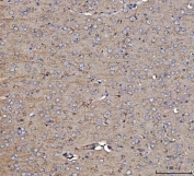 IHC staining of FFPE mouse brain tissue with Dickkopf-1 antibody. HIER: boil tissue sections in pH8 EDTA for 20 min and allow to cool before testing.