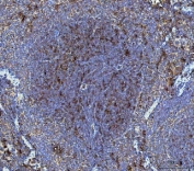 IHC staining of FFPE mouse spleen tissue with Dickkopf-1 antibody. HIER: boil tissue sections in pH8 EDTA for 20 min and allow to cool before testing.