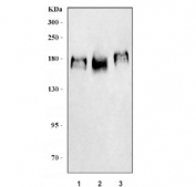 Western blot testing of 1) human HeLa, 2) human MCF7 and 3) mouse NIH 3T3 cell lysate with ERBB2 antibody. Expected molecular weight: 139-185 kDa depending on glycosylation level.