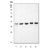 Western blot testing of human 1) MCF7, 2) HepG2, 3) HeLa, 4) U-87 MG and 5) A549 cell lysate with ERCC1 antibody. Predicted molecular weight ~36 kDa.