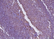 IHC staining of FFPE human tonsil tissue with Junctional adhesion molecule A antibody. HIER: boil tissue sections in pH8 EDTA for 20 min and allow to cool before testing.