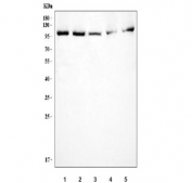 Western blot testing of 1) human MCF7, 2) human HeLa, 3) human A549, 4) rat RH35 and 5) mouse NIH 3T3 cell lysate with FER antibody. Predicted molecular weight: ~95 kDa.