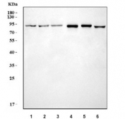 Western blot testing of 1) human HeLa, 2) human 293T, 3) human A549, 4) rat kidney, 5) mouse kidney and 6) mouse NIH 3T3 cell lysate with Fes/Fps antibody. Predicted molecular weight ~93 kDa.