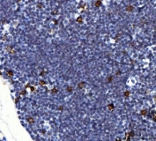 IHC staining of FFPE mouse thymus tissue with Il2r alpha antibody. HIER: boil tissue sections in pH8 EDTA for 20 min and allow to cool before testing.