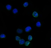 Immunofluorescent staining of FFPE mouse RAW264.7 cells with Il2r alpha antibody (green) and DAPI nuclear stain (blue). HIER: steam section in pH6 citrate buffer for 20 min.