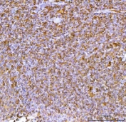IHC staining of FFPE human tonsil tissue with Interleukin 34 antibody. HIER: boil tissue sections in pH8 EDTA for 20 min and allow to cool before testing.