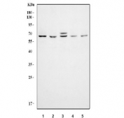 Western blot testing of huma 1) Jurkat, 2) CCRF-CEM, 3) 293T, 4) HeLa and 5) MCF7 cell lysate with KAT5 antibody. Predicted molecular weight ~59 kDa.