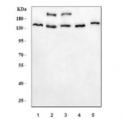 Western blot testing of 1) human HeLa, 2) human 293T, 3) human HEL, 4) rat C6 and 5) mouse NIH 3T3 cell lysate with JHDM3A antibody. Predicted molecular weight ~121 kDa.