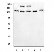 Western blot testing of 1) human HeLa, 2) human 293T, 3) human HEL, 4) rat C6 and 5) mouse NIH 3T3 cell lysate with JHDM3A antibody. Predicted molecular weight ~121 kDa.