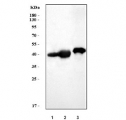 Western blot testing of 1) rat kidney, 2) rat skeletal muscle and 3) mouse skeletal muscle tissue lysate with MAP2K6 antibody. Predicted molecular weight ~37 kDa.