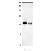 Western blot testing of 1) rat brain and 2) mouse brain tissue lysate with NCAN antibody. Predicted molecular weight ~143 kDa (unmodified), up to ~250 kDa (fully glycosylated).