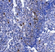IHC staining of FFPE human tonsil tissue with NCR1 antibody. HIER: boil tissue sections in pH8 EDTA for 20 min and allow to cool before testing.