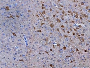 IHC staining of FFPE rat brain tissue with Neuromedin-S antibody. HIER: boil tissue sections in pH8 EDTA for 20 min and allow to cool before testing.