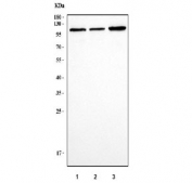 Western blot testing of 1) human HEL, 2) human RT4 and 3) human U-251 cell lysate with PPP1R15A antibody. Predicted molecular weight ~73 kDa, can be observed at up to ~110 kDa.