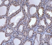 IHC staining of FFPE human thymus tissue with Protein arginine N-methyltransferase 5 antibody. HIER: boil tissue sections in pH8 EDTA for 20 min and allow to cool before testing.