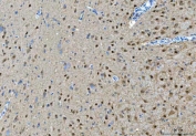 IHC staining of FFPE rat brain tissue with Protein arginine N-methyltransferase 5 antibody. HIER: boil tissue sections in pH8 EDTA for 20 min and allow to cool before testing.