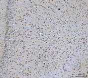 IHC staining of FFPE rat brain tissue with Protein arginine N-methyltransferase 5 antibody. HIER: boil tissue sections in pH8 EDTA for 20 min and allow to cool before testing.