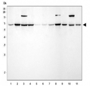 Western blot testing of 1) human HepG2, 2) human Jurkat, 3) human Raji, 4) human 293, 5) human HL60, 6) human PC-3, 7) human A431, 8) human Daudi, 9) rat brain, 10) rat C6 and 11) mouse brain tissue lysate with Protein arginine N-methyltransferase 5 antibody. Expected molecular weight ~72 kDa.