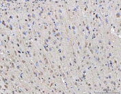 IHC staining of FFPE rat brain tissue with RGS12 antibody. HIER: boil tissue sections in pH8 EDTA for 20 min and allow to cool before testing.