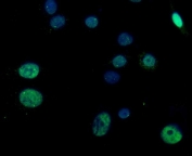 Immunofluorescent staining of FFPE human A549 cells with RGS12 antibody (green) and DAPI nuclear stain (blue). HIER: steam section in pH6 citrate buffer for 20 min.