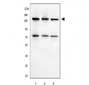 Western blot testing of 1) human RT4, 2) human SH-SY5Y and 3) human HepG2 cell lysate with RGS12 antibody. Predicted molecular weight ~156 kDa with multiple isoforms between 55 kDa and 156 kDa.
