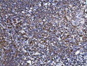 IHC staining of FFPE human tonsil tissue with SPT5 antibody. HIER: boil tissue sections in pH8 EDTA for 20 min and allow to cool before testing.