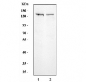 Western blot testing of 1) human HeLa and 2) mouse RAW264.7 cell lysate with SPT5 antibody. Predicted molecular weight ~121 but commonly observed at up to ~160 kDa.