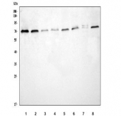 Western blot testing of 1) human SH-SY5Y, 2) human Daudi, 3) rat testis, 4) rat brain, 5) rat C6, 6) mouse testis, 7) mouse brain and 8) mouse NIH 3T3 cell lysate with TCF4 antibody. Predicted molecular weight ~71 kDa.