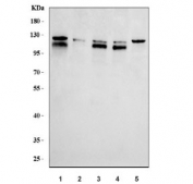 Western blot testing of 1) human Jurkat, 2) human Raji, 3) human Daudi, 4) human MOLT4 and 5) rat thymus tissue lysate with TLR9 antibody. Predicted molecular weight 110 kDa-116 kDa (multiple isoforms).