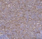 IHC staining of FFPE human spleen tissue with TLR9 antibody. HIER: boil tissue sections in pH8 EDTA for 20 min and allow to cool before testing.